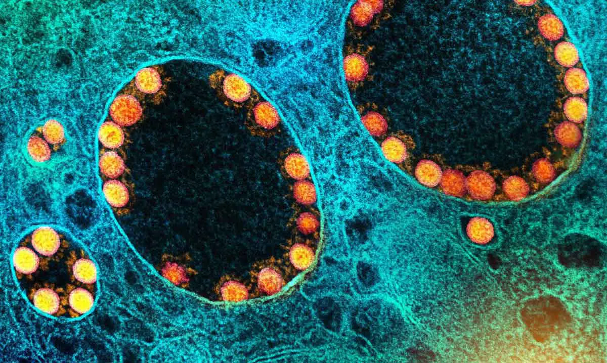 Pesquisa realizada pela Fiocruz e Universidade de Oxford, revela que a terceira dose da vacina AstraZeneca aumenta anticorpos neutralizantes contra Ômicron