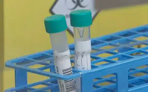 Sesapi registra 105 casos de Influenza H3N2 no Piauí