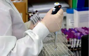 SESAPI confirma primeiro caso de 'Flurona' no Piauí