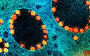 1º caso de 'Éris' subvariante do coronavírus é registrado no Brasil