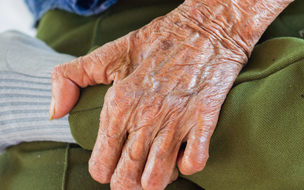 Hanseníase é tema de debate em seminário de saúde no Piauí