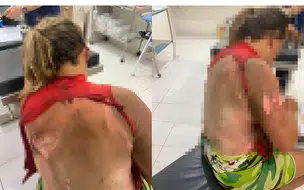 Homem é preso após atear fogo na companheira enquanto ela dormia no Piauí