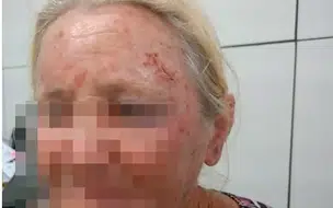 Idosa luta com bandidos fere um deles e os expulsa de casa durante assalto no PI