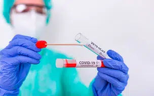 Casos de Covid-19 continuam em queda no Piauí