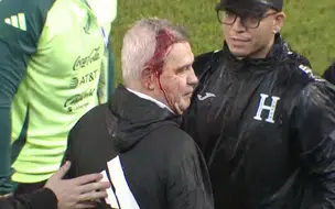 Técnico do México é ferido na cabeça com garrafa após jogo contra Honduras