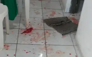 Homem chega bêbado em casa e agride esposa com faca por não encontrar comida