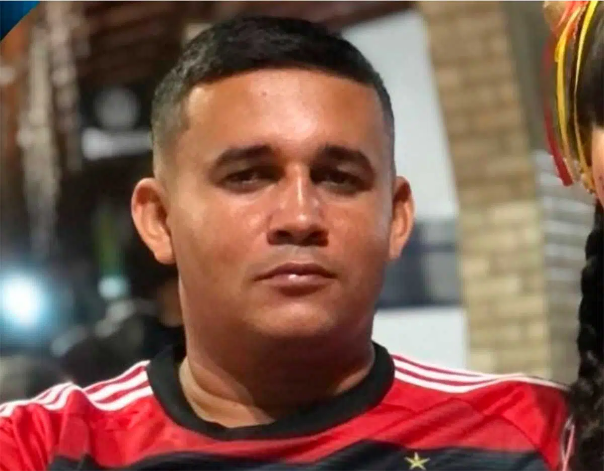 Murilo teve queimaduras de 1° e 2° grau nos membros inferiores, superiores, tórax, abdômen e costas.
