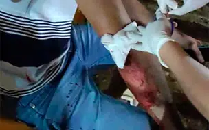 Cinco pessoas ficam feridas em tiroteio na zona leste de Teresina