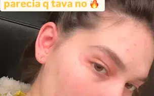 Com reação alérgica Virgínia retorna ao hospital após ter alta da maternidade