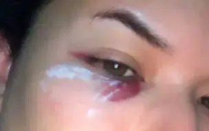 Corpo de bombeiros PI diz que vai investigar sargento após denúncia de agressão