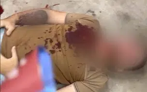 Filho de Policial Militar Morre Após Ataque a Tiros em Sobral-Ceará