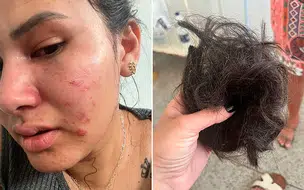 Blogueira fica com rosto machucado e tem cabelo cortado em ataque no Piauí