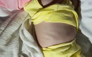 Descaso médico coloca vida de recém-nascida em risco em Alto Longá; família denuncia negligência