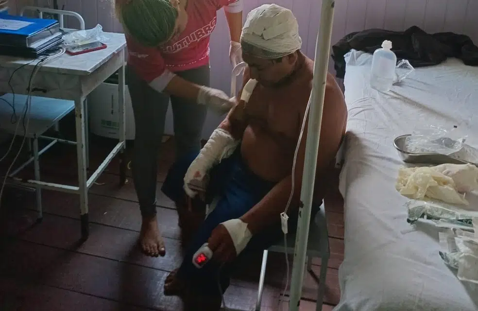 O animal avançou de forma repentina e causou um corte profundo no crânio do cacique.