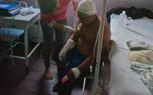 Cacique da comunidade indígena do Rio Tumiã, em Lábrea, na Amazonas, sobreviveu a um ataque de onça