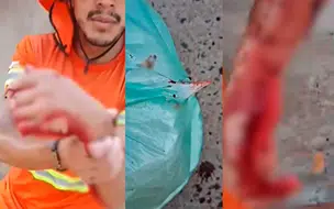 Funcionário da coleta de lixo fica gravemente ferido com caco de vidro em Teresina