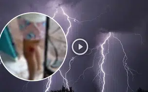 Raio atinge casa em Buriti dos Lopes e jovem fica ferida durante forte chuva