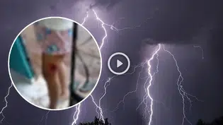 Raio atinge casa em Buriti dos Lopes e jovem fica ferida durante forte chuva