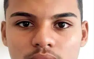 SESAPI confirma óbito de adolescente de 17 anos por mordida de sagui
