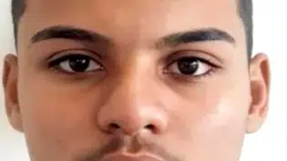 SESAPI confirma óbito de adolescente de 17 anos por mordida de sagui