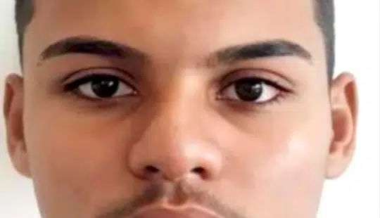 SESAPI confirma óbito de adolescente de 17 anos por mordida de sagui