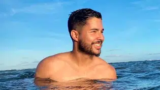 Ataque: Jovem tem rosto queimado com água quente pela namorada em Corrente