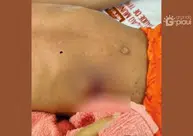 Criança de 4 anos é baleada durante brincadeira com arma caseira em Nazária