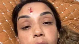 Cantora denuncia ex por agressão e aparece com rosto sangrando nas redes sociais