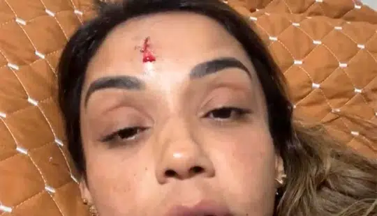 Cantora denuncia ex por agressão e aparece com rosto sangrando nas redes sociais
