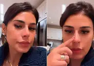 Nariz de Simone Mendes repercute na internet e cantora nega intervenção cirúrgica