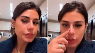 Nariz de Simone Mendes repercute na internet e cantora nega intervenção cirúrgica