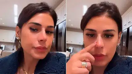 Nariz de Simone Mendes repercute na internet e cantora nega intervenção cirúrgica
